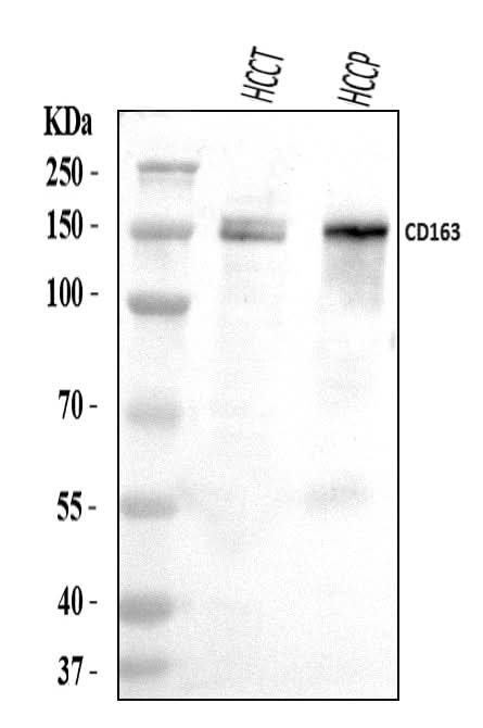 Anti-CD163 Antibody Picoband® Boster Bio