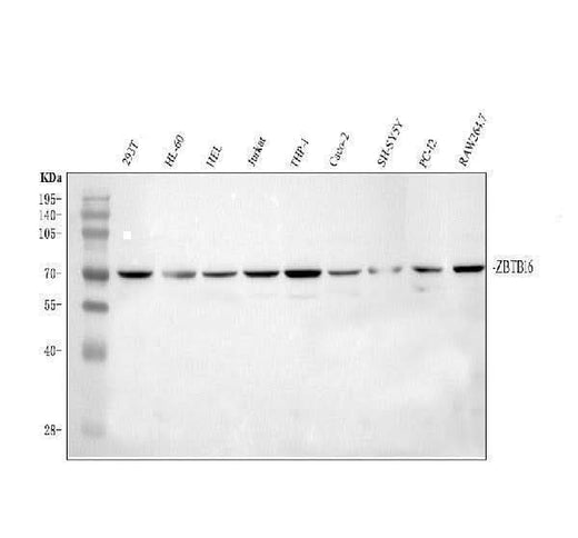 Anti-Plzf/ZBTB16 Antibody Picoband® Boster Bio