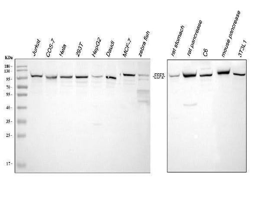 Anti-EEF2 Antibody Picoband® Boster Bio