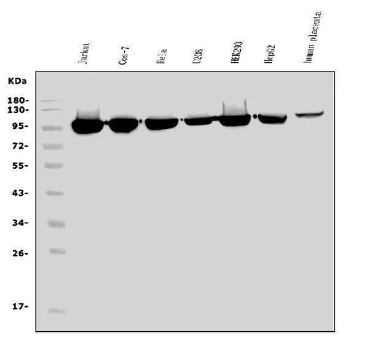 Anti-EEF2/Elongation factor 2 Antibody Picoband® Boster Bio