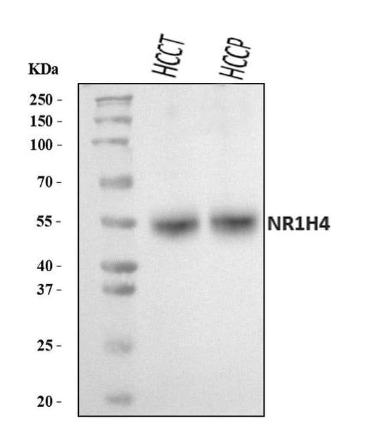 Anti-Bile Acid Receptor NR1H4 Antibody Picoband® Boster Bio
