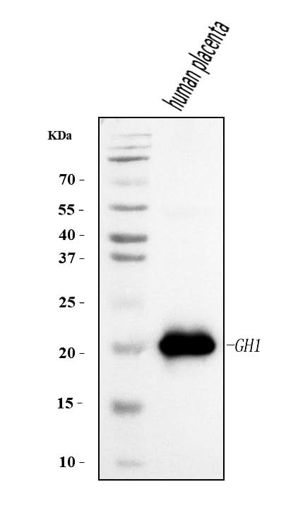 Anti-Growth Hormone/GH1 Antibody Picoband® Boster Bio
