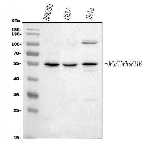 Anti-Osteoprotegerin/TNFRSF11B Antibody Picoband® Boster Bio