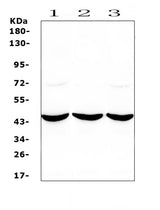 Anti-ADA Antibody Picoband® Boster Bio
