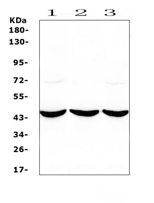 Anti-ADA Antibody Picoband® Boster Bio