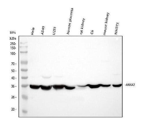 Anti-Annexin A2/ANXA2 Antibody Picoband® Boster Bio