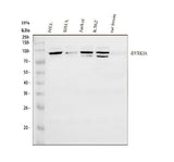 Anti-DYRK1A Antibody Picoband® Boster Bio
