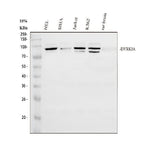 Anti-DYRK1A Antibody Picoband® Boster Bio