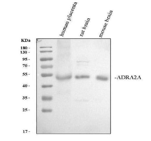 Anti-alpha 2a Adrenergic Receptor/ADRA2A Antibody Picoband® Boster Bio