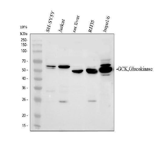 Anti-Glucokinase/GCK Antibody Picoband® Boster Bio