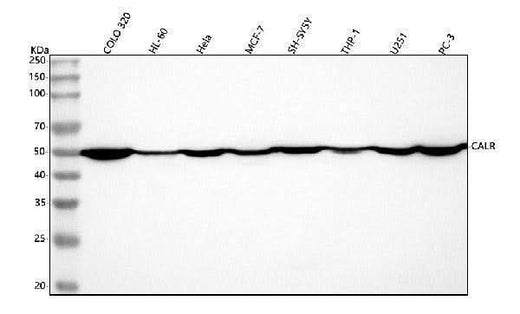 Anti-Calreticulin/CALR Antibody Picoband® Boster Bio