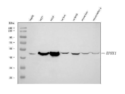 Anti-Epoxide hydrolase/EPHX1 Antibody Picoband® Boster Bio
