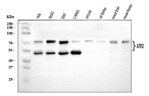 Anti-ATF2 Antibody Picoband® Boster Bio