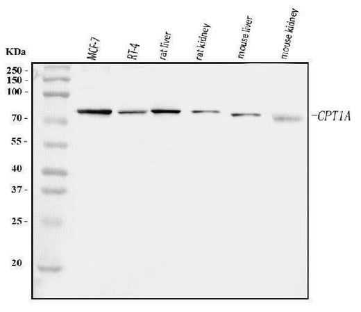 Anti-CPT1A Antibody Picoband® Boster Bio