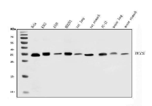 Anti-HCCS Antibody Picoband® Boster Bio
