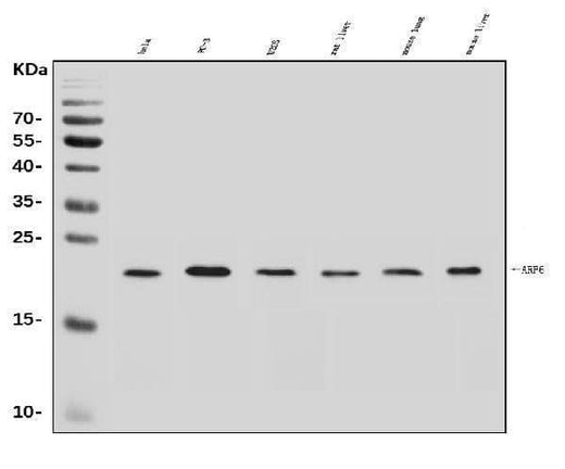 Anti-ARF6 Antibody Picoband® Boster Bio