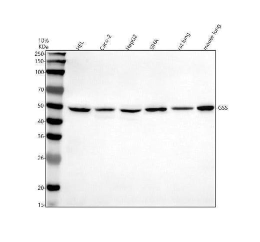 Anti-GSS Antibody Picoband® Boster Bio