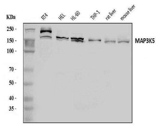 Anti-ASK1/MAP3K5 Antibody Picoband® Boster Bio