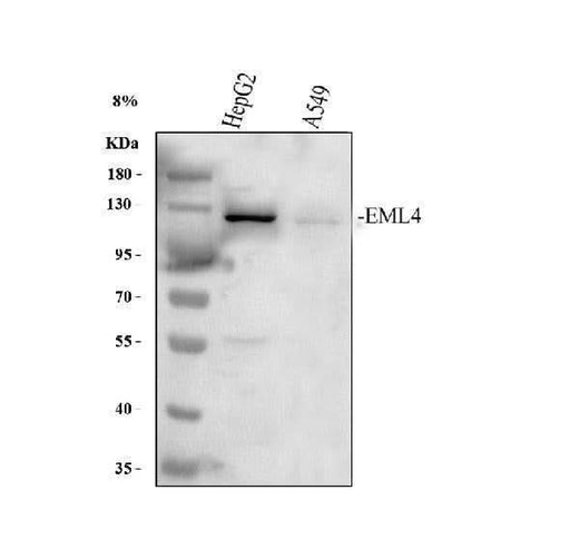 Anti-EML4 Antibody Picoband® Boster Bio