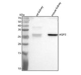 Anti-Aqp2 Antibody Picoband® Boster Bio