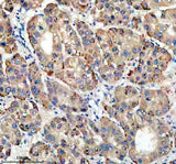 Anti-TIRAP Antibody Boster Bio