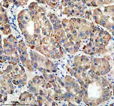 Anti-TIRAP Antibody Boster Bio