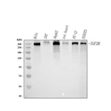 Anti-Mannose 6 Phosphate Receptor (Cation independent)/IGF2R Antibody Picoband® Boster Bio