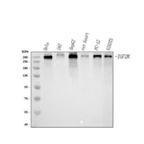 Anti-Mannose 6 Phosphate Receptor (Cation independent)/IGF2R Antibody Picoband® Boster Bio