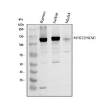 Anti-NFAT1/NFATC2 Antibody Picoband® Boster Bio