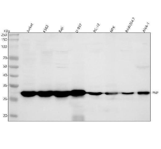 Anti-PNP Antibody Picoband® Boster Bio