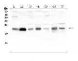 Anti-Caveolin-3/CAV3 Antibody Picoband® Boster Bio