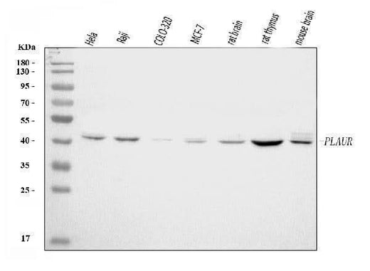 Anti-uPA Receptor/U-PAR/PLAUR Antibody Picoband® Boster Bio