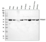 Anti-AMPK alpha 1/PRKAA1 Antibody Picoband® Boster Bio