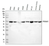 Anti-AMPK alpha 1/PRKAA1 Antibody Picoband® Boster Bio