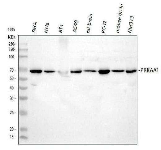 Anti-AMPK alpha 1/PRKAA1 Antibody Picoband® Boster Bio
