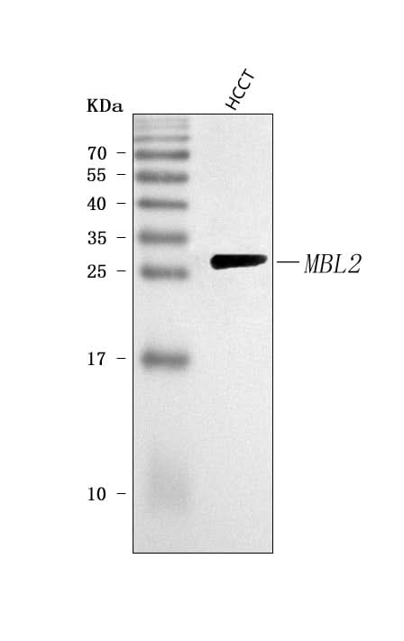 Anti-MBL2 Antibody Picoband® Boster Bio