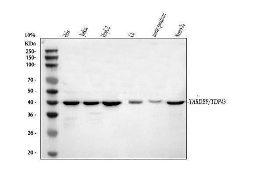 Anti-TDP-43/TARDBP Antibody Picoband® Boster Bio
