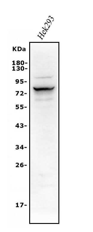 Anti-Alkaline phosphatase/ALPL Antibody Picoband® Boster Bio