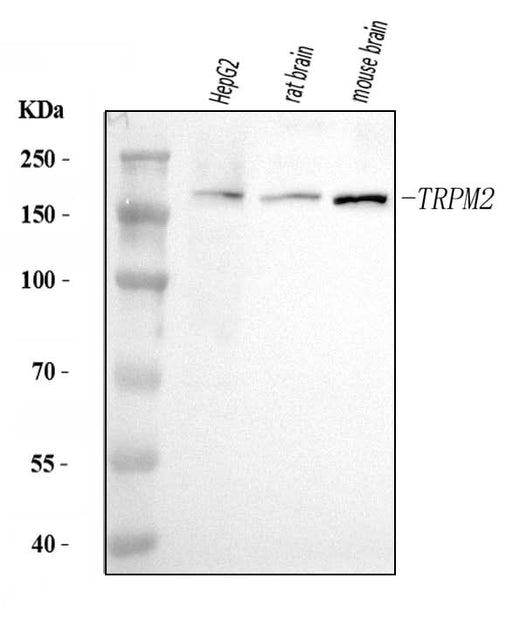 Anti-TRPM2 Antibody Picoband® Boster Bio