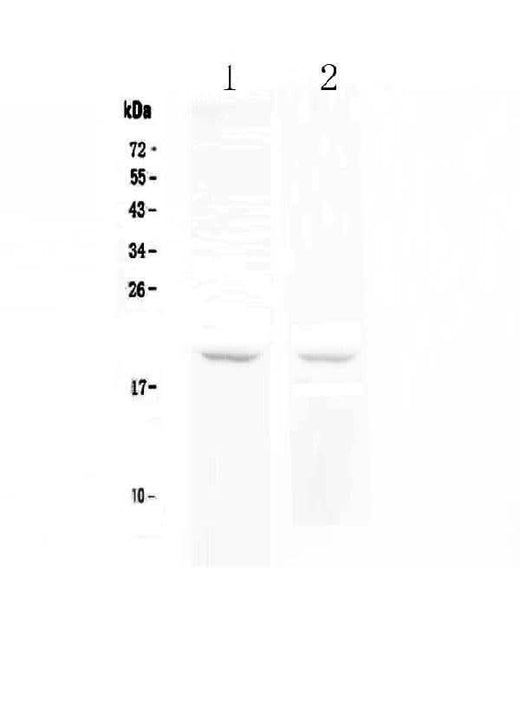 Anti-BCMA/TNFRSF17 Antibody Picoband® Boster Bio