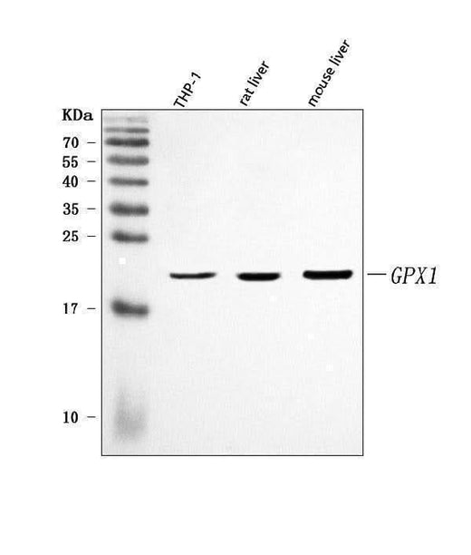 Anti-GPX1 Antibody Picoband® Boster Bio