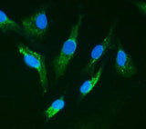 Anti-IRAK/IRAK1 Antibody Picoband® Boster Bio