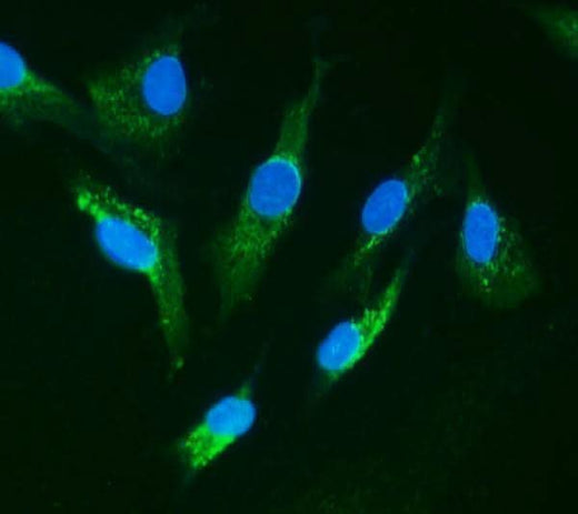 Anti-IRAK/IRAK1 Antibody Picoband® Boster Bio