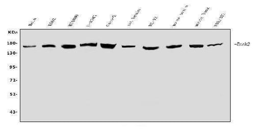 Anti-ROCK2 Antibody Picoband® Boster Bio
