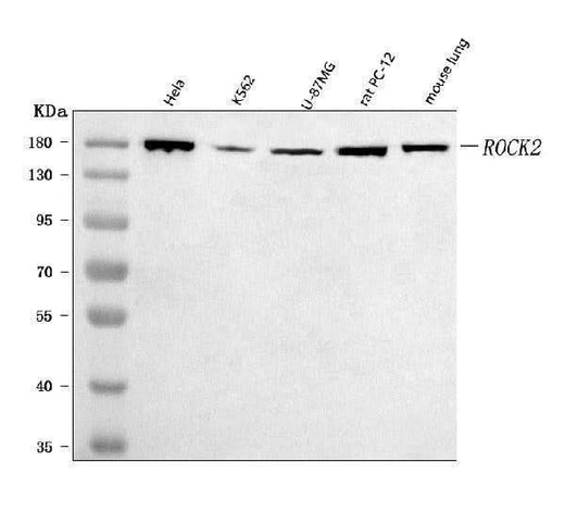 Anti-ROCK2 Antibody Picoband® Boster Bio