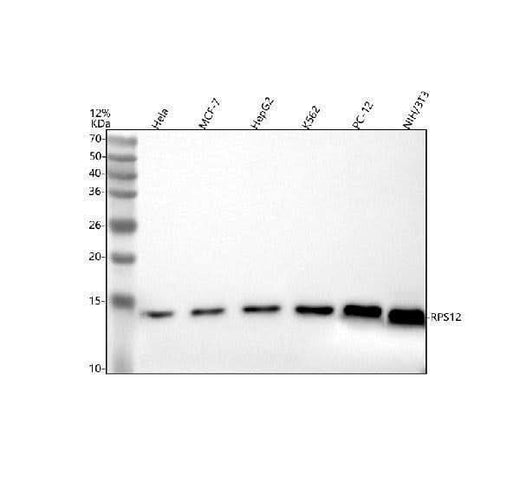 Anti-CHCHD6 Antibody Picoband® Boster Bio