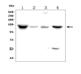 Anti-Natriuretic Peptide Receptor A/GC-A/NPR1 Picoband® Antibody Boster Bio