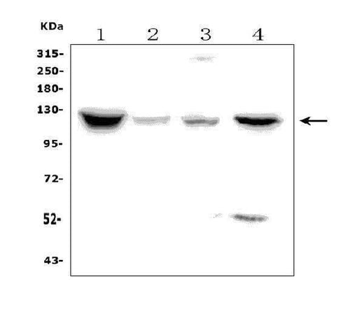 Anti-Natriuretic Peptide Receptor A/GC-A/NPR1 Picoband® Antibody Boster Bio