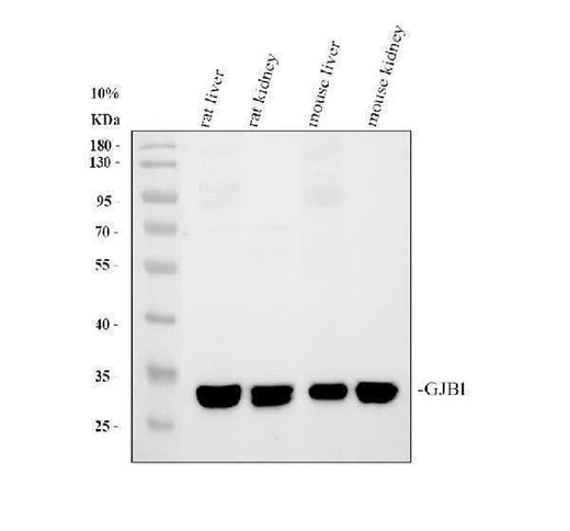 Anti-Connexin 32/GJB1 Antibody Picoband® Boster Bio