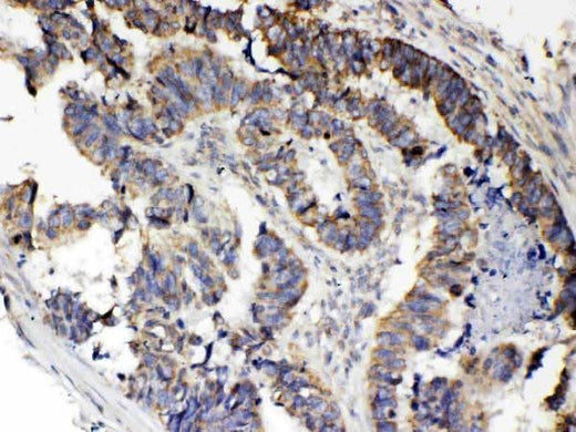 Anti-RANK/TNFRSF11A Antibody Picoband® Boster Bio